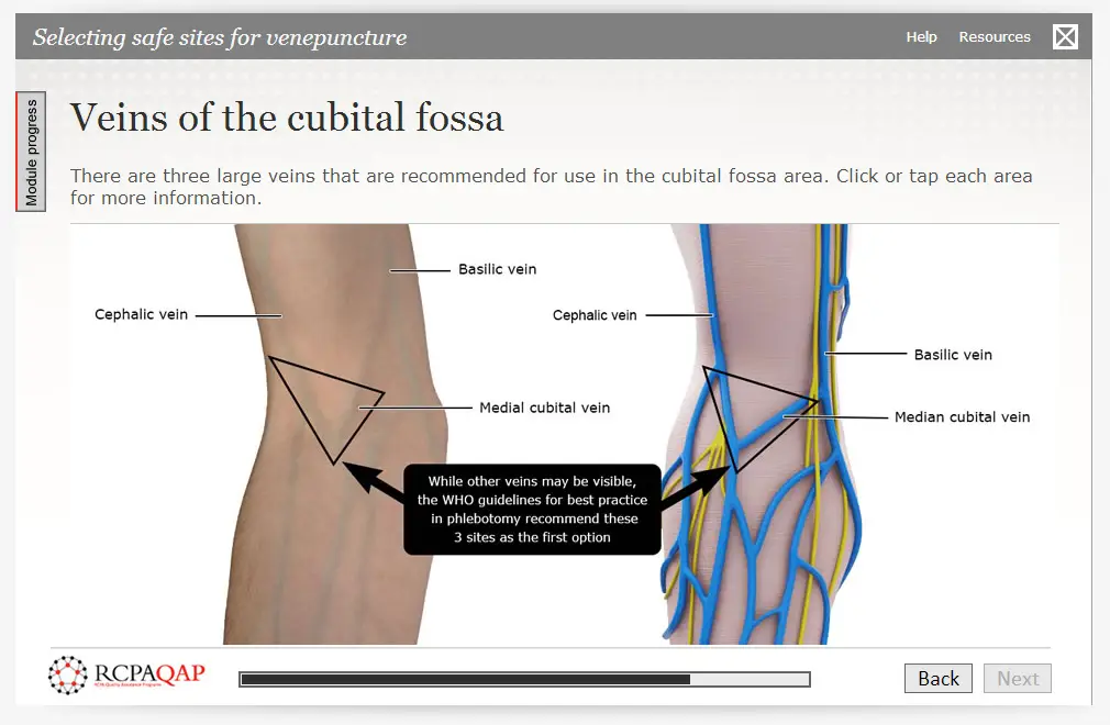 Illustration of veins of the cubital fossa