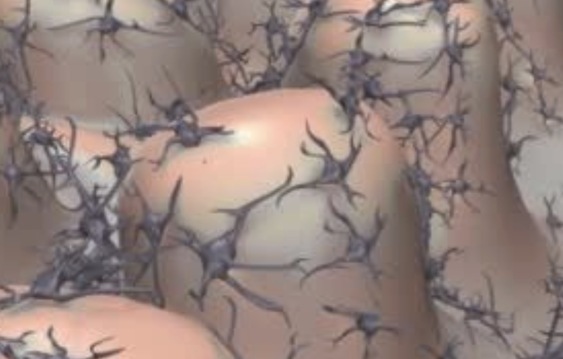 3D medical animation of melanoma development in human skin, showing abnormal melanocyte growth and the progression from a normal mole to a malignant tumour, created by Animated Biomedical Productions (ABP).